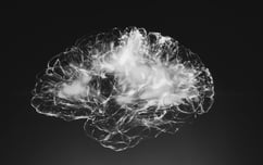 Neuroideenmanagement 2 – das Gehirn als Sozialorgan